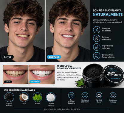 Blanqueador De Dientes Carbon